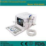 CE Approved Portable B-Mode Ultrasonic/ Ultrasound Scanner With 3.5Mhz Multi-frequency Convex Probe RUS-6000D thumbnail-1