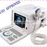CE ISO Certificate Multi-frequency Optional Probe Ultrasound Scanner RUS 6000D Exporter thumbnail-1