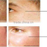 Intracel Fractional rf Microneedle Machine/fractional rf Skin Rejuvenation Beauty Equipment thumbnail-5