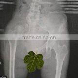 Made in China ct Film, Sex Sex Sex Images,x-ray Dry Film thumbnail-1