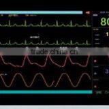 Medical Monitor thumbnail-1