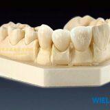 Wieland Zenostar Dental Crown, Solid Zirconia Bruxzir, Dental Teeth, Laboratoire Dentaire, Dentallabor, Laboratorio Dental, Dental Laboratory, Shenzhen LJ Dental Lab China thumbnail-2