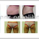 Portable Factory Price Advanced Ultrasound Sliming Machine thumbnail-5