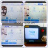 Facial Veins Treatment Tatoo Removal Q-switched Nd Yag Laser 500W With Super Cooling Freckles Removal thumbnail-4