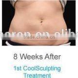 Cellulite Freezing Cool Shaping Body Massage Equipment for Weight Loss thumbnail-4