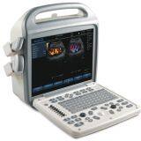 Popular Portable Color Doppler Ultrasound Scanner thumbnail-2