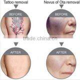 Best China Hot Sale!! Super Fast Color Touch Screen Facial Whitening Machine 10HZ thumbnail-6