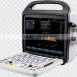 Factory SUPPLY Portablolor Ultrasound Machines/ultrasound Scanner CE Approval Doppler Ultrasound Scanner thumbnail-3