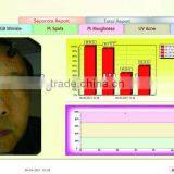 WT-03-B Big Facial Skin Analyzer Magic Mirror thumbnail-5