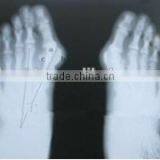 Manufacturer of Dry Film, Radiology Medical Film, Low Price x Ray Film, Printed With Fuji and Agfa thumbnail-1