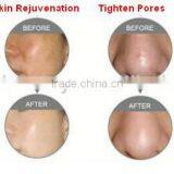 Woman Beauty Machine RF Fractional CO2 Laser Carboxytherapy Vaginal Tightening And Rejuvenation Treatment With Medical CE Skin Tightening thumbnail-2