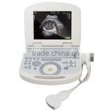 Hign Quality Ultrasound Machine With Low Price thumbnail-2