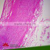 Fixed Set 100 Pieces for Higher Medical Educational Histopathology Slides thumbnail-5