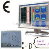 CE Approved 24 Hours Continuous Recording 24 32 Channel Digital EEG Mapping Machine thumbnail-1