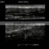 UProbe-20 Probe Type Ultrasound Scanner for Laptop thumbnail-6