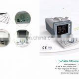 MY-A001A Laptop Full Digital Portable Ultrasound Scanner Mini Ultrasound Machine thumbnail-3