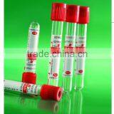 Vacuum Blood Collection Tube( EDTAK2 )