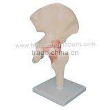 Hip Joint With Ligament Model thumbnail-1