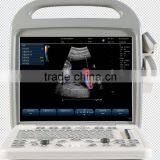 Factory SUPPLY Portablolor Ultrasound Machines/ultrasound Scanner CE Approval Doppler Ultrasound Scanner thumbnail-2