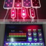 Osano Manufacturer for Sale Lipo Laser Slimming Machine thumbnail-4