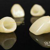 Dental Crown E.Max Ceramic, Porcelain Crown, Dental Veneers, Laboratoire Dentaire, Dentallabor, Laboratorio Dental, Dental Laboratory, Shenzhen LJ Dental Lab China thumbnail-2