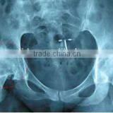 Medical x Ray Dry Imaging Film of Hospital,printed With Fuji & Agfa,KND-A/F thumbnail-2