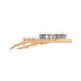 External Fixation Device