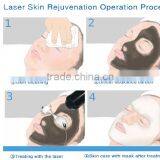 Himalaya Cheap Portable Yag Laser thumbnail-6