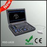Laptop Ultrasonic Diagnostic System thumbnail-3