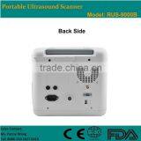 CE Approved Laptop/Portable Ultrasound Scanner With 3.5Mhz Multi-frequency Convex Probe RUS-9000B thumbnail-4