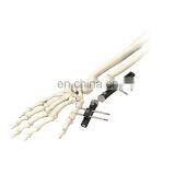 High Quality Wrist Joint External Fixator Orthopedic Surgical Instrument thumbnail-5