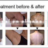 2015 Newest Diode Laser!Pain Free CE Approved Diode Laser Body Hair Removal thumbnail-5