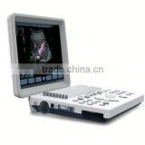 Laptop Color Doppler Ultrasound Syatem With Transducers thumbnail-3