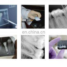 Medical Equipments Dark Box Operating Manual Medical Instruments Dental Automatic X-Ray Film Processor for Dental Use thumbnail-5