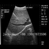 Portable Color Doppler Laptop Ultrasound, Dw-C60 Ultrasonic Machine thumbnail-2