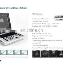 Portable Full Digital 15inch 2D 4D Medical Ultrasound Instruments for Hospital Use thumbnail-4