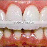 Human Oral Pathology Medical Prepared Slides for Teaching thumbnail-2