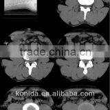 x Ray Blue Film Manufacturers,x Ray Equipment Suppliers,x Ray Film Medical thumbnail-1