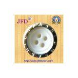 Brass Ring Covered Shirt Buttons thumbnail-1