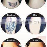 1-10Hz Powerful Big Movable Screen Professional Freckles Removal Machine Active Laser Tattoo Removal Q Switch Laser Tattoo Removal thumbnail-6