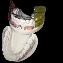 Orthodontic-Appliance China Dental Laboratory - Outsourcing Dental Lab thumbnail-5