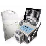 MY-D049V Hospital Device 500mA Digital Mobile Radiography System Medical x Ray Machine Price X-ray Scanner thumbnail-6