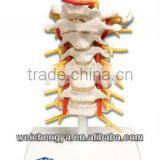 Cervical Vertebral Column With Neck Artery, Occipital, Herniated Disc and Nerves
