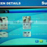 SW-203E E-light IPL RF+ND YAG Laser Multifunction Laser Hair Removal E-light Ipl thumbnail-2
