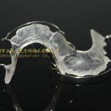 Hawley Retainer, Begg Retainer, Wrap Around Retainer, Orthodontic Retainers, Dental Orthodontic Appliance, Laboratoire Dentaire, Dentallabor, Laboratorio Dental, Dental Laboratory, Shenzhen LJ Dental Lab China thumbnail-4