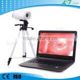 LTY9800 Beautiful Full hd Vagina Colposcope