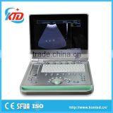 China Portable B/W Diagnostic Ultrasound Scanner System Price