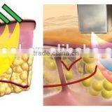 Hot Product 2015 Slimming Tripolar Radio Frequency Machine RF thumbnail-6