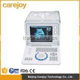 Portable Ultrasound Scanner Ultrasonic Diagnostic Machine System RUS-6000D With 3.5MHz Convex Probe Factory thumbnail-1