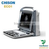 medical hospital User-friendly and Modern Design b/w 2d portable Chison ultrasound